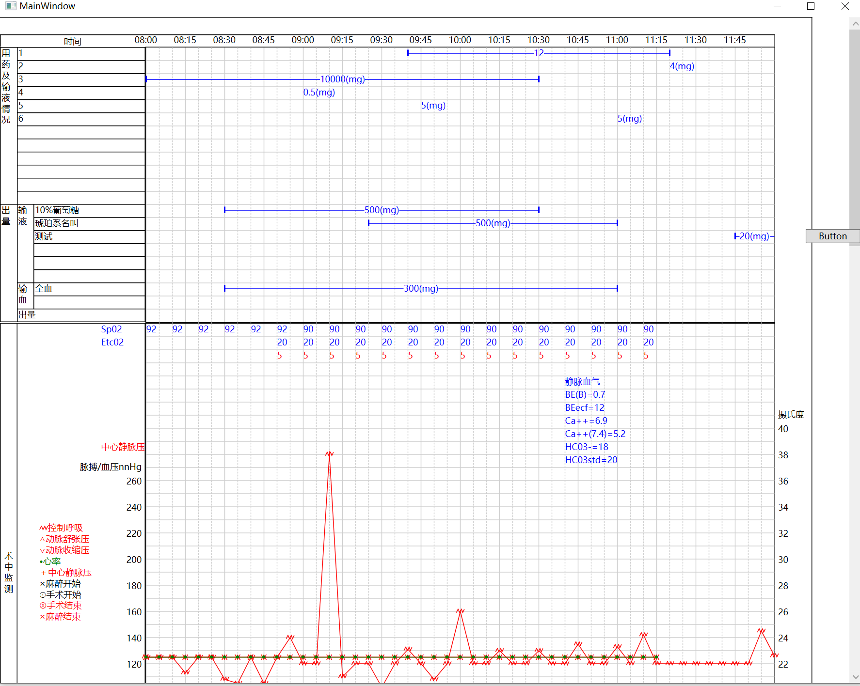 GitHub Daixin0 GanttChartWPF Gantt Chart For WPF